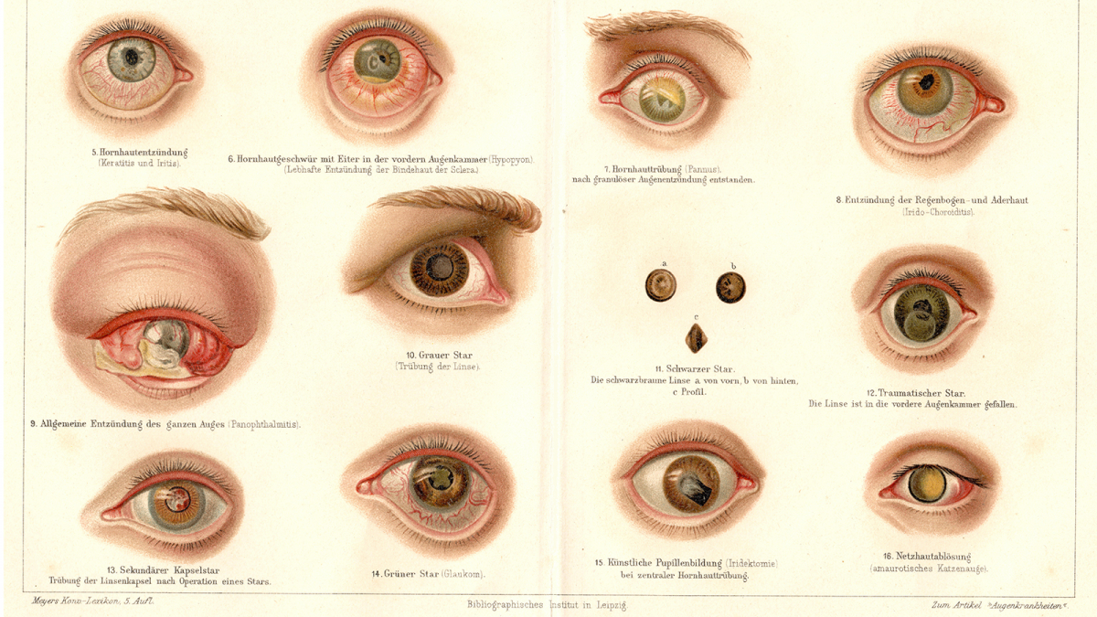 Historische overzichtsfoto van oogaandoeningen