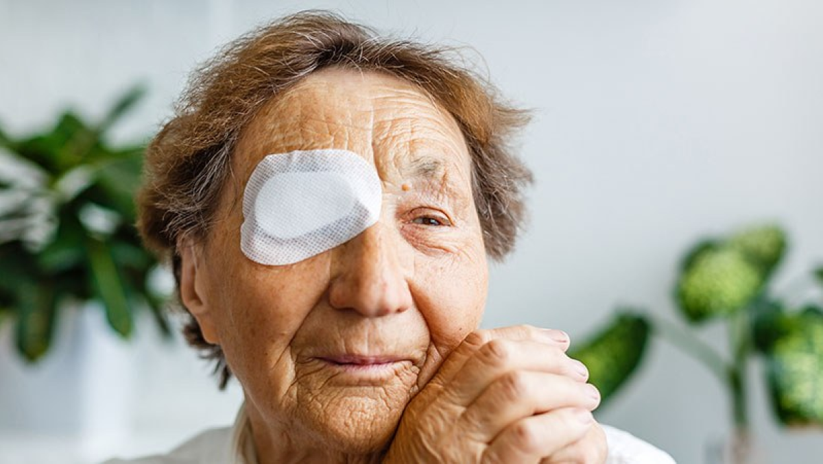 Oudere dame met oogverband na cataractoperatie